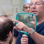 How to Find the Best Hair Transplant Surgeon