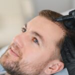 How Turkey Became The Global Capital Of Hair Transplants In 2022